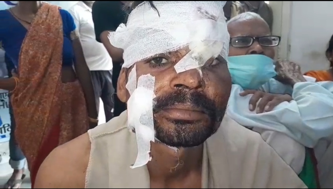 वृंदावन में साधु की चाकू से गोदकर हत्या, बीच-बचाव में आए मजदूर पर भी जानलेवा हमला; नशे के विवाद में वारदात से सनसनी